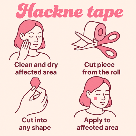 Hackne Tape